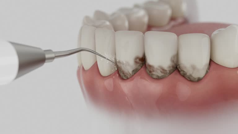Reliable Dental Implants contractor in Dawson, TX by Smile Center Dentistry
